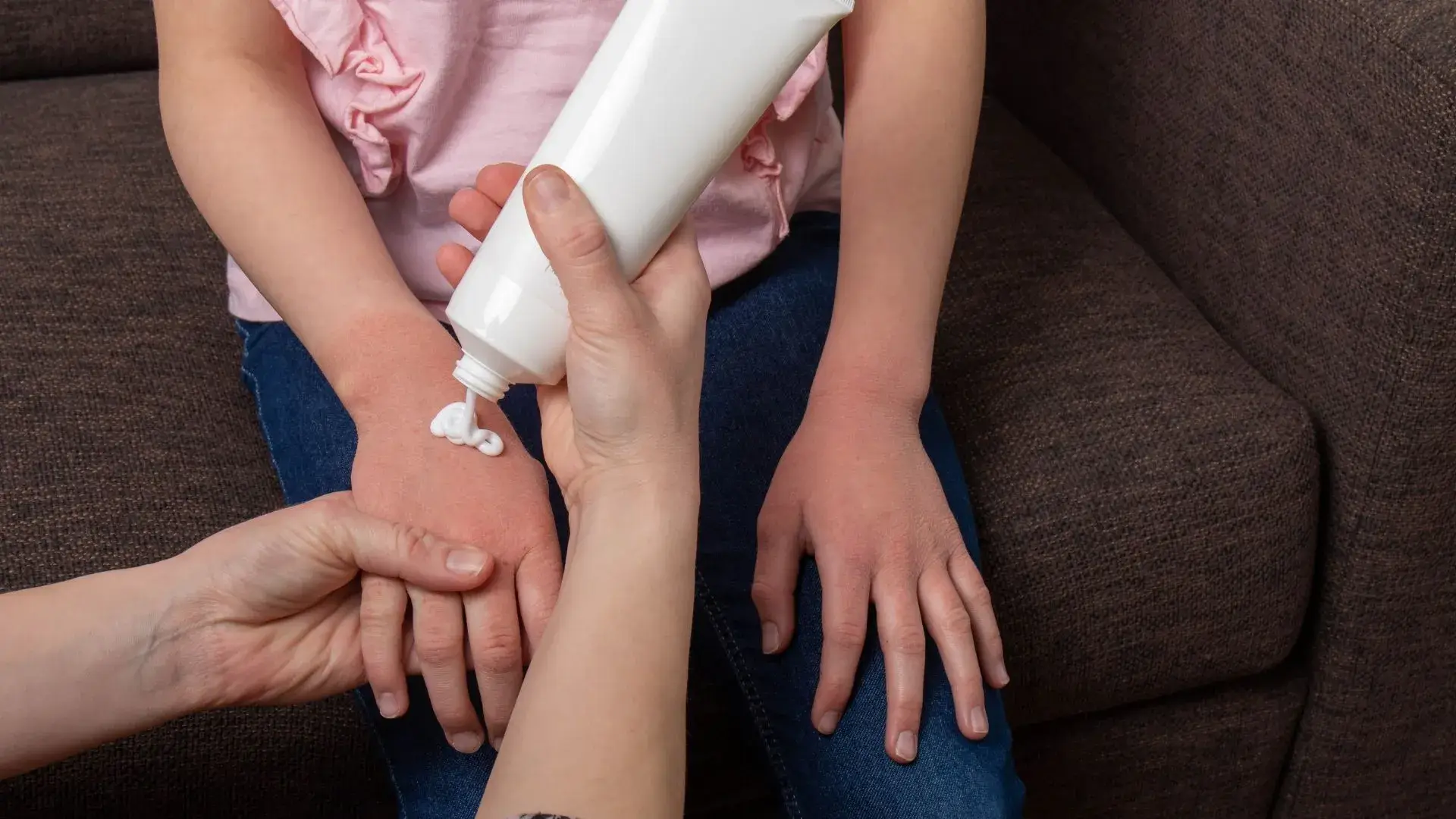 Eczema Treatment in Mississauga