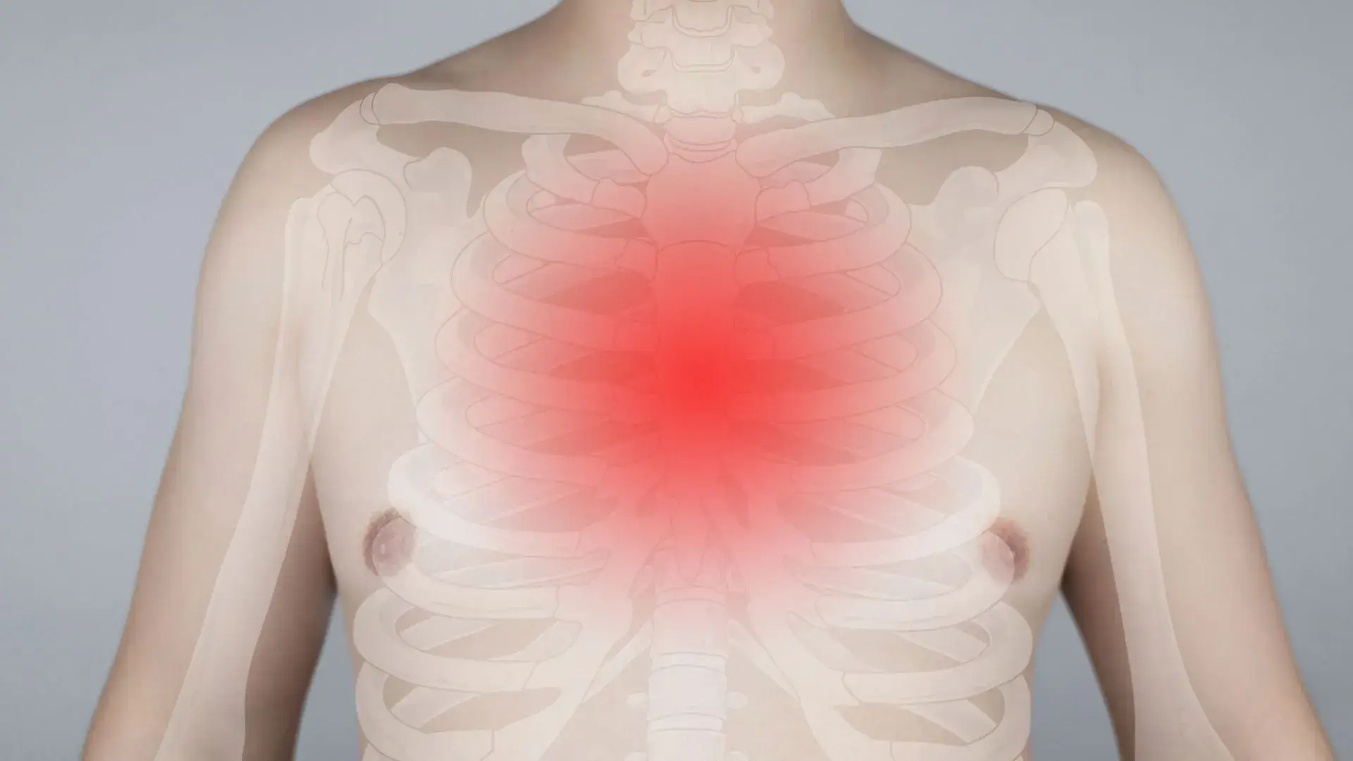 How Thoracic Outlet Syndrome Affects Your Body