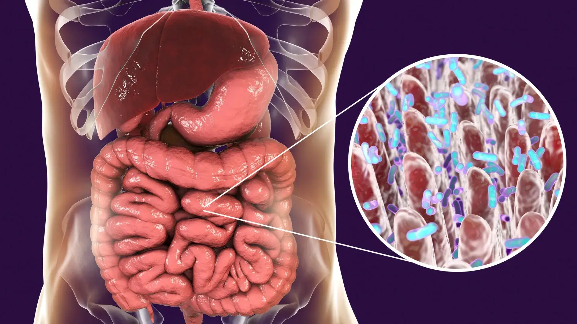 Small Intestinal Bacterial Overgrowth (SIBO)