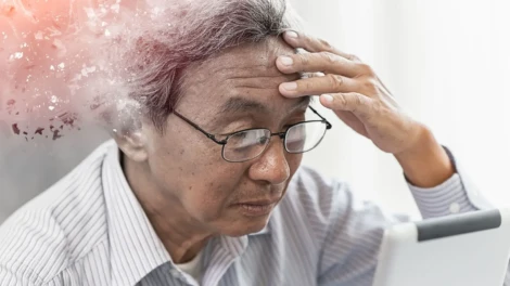 Alzheimer’s Disease