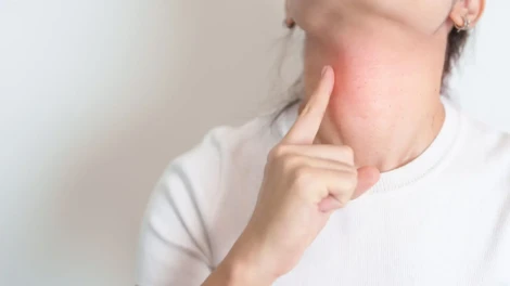 Hypothyroidism