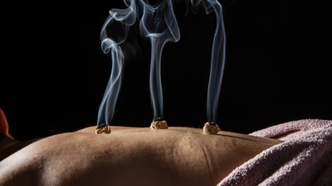 Moxibustion for Turning Breech Babies