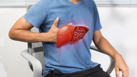 Nonalcoholic Fatty Liver Disease (NAFLD)