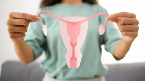 Polycystic Ovary Syndrome (PCOS)