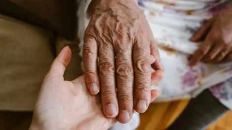 Varicose Veins